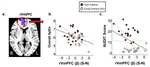 Irregular Autonomic Modulation Predicts Risky Drinking and Altered Ventromedial Prefrontal Cortex Response to Stress in Alcohol Use Disorder